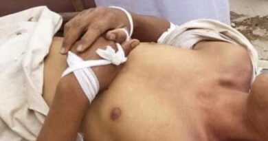 ضربوه بأعقاب البنادق.. مقتل شاب على أيدي قيادي حوثي في صعدة