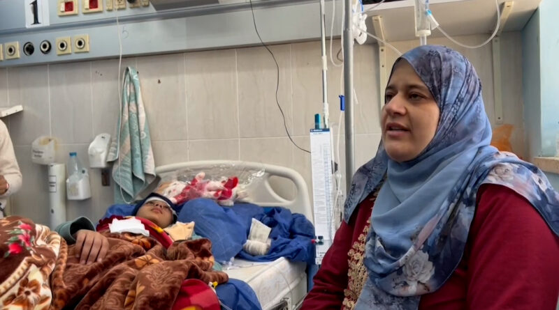 ما قصة الطفلة نغم ومعاناتها مع إصابتها بشظايا في الرأس بغزة